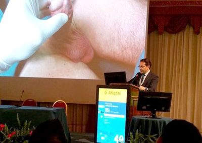 XXXII Congresso Nacional da SIA de Stresa © Antonini Urology 2015